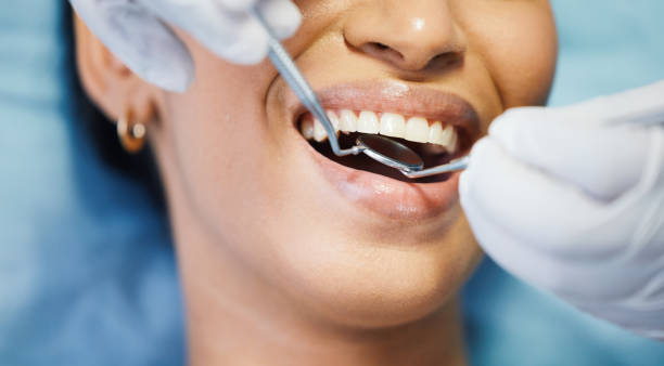 Best Emergency Dental Extractions in Greenville, MI
